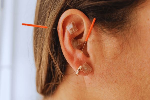 Tui Na and Ear Acupuncture