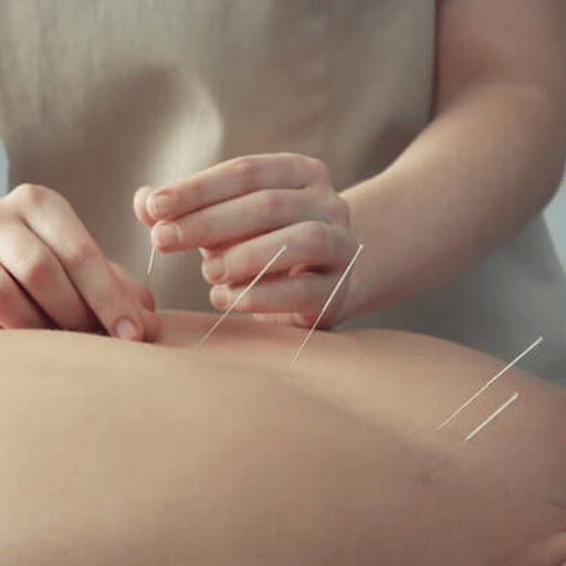 How Acupuncture Triggers Weight Loss — The Neuroendocrine Mechanism