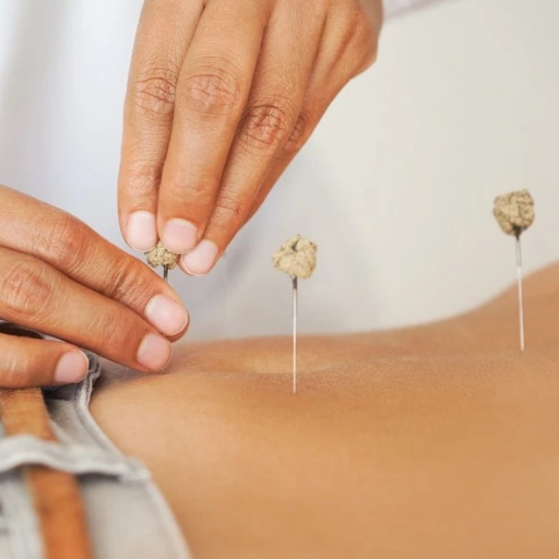 What Is Fertility Acupuncture? A TCM Perspective on Reproductive Health