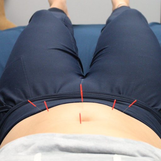 Does Fertility Acupuncture Actually Work? What Clinical Research Shows