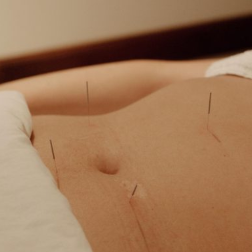 Should You Try Fertility Acupuncture? A Decision Framework