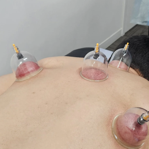 Hijama in the UAE 2026: Licensing, Standards & Choosing a Provider