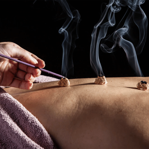 How Does Moxibustion Work? TCM Theory Meets Modern Research