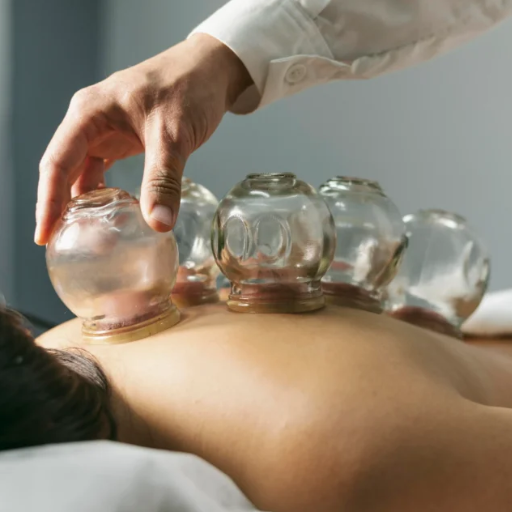 Hijama vs Cupping Therapy: Why the Distinction Matters in Islam