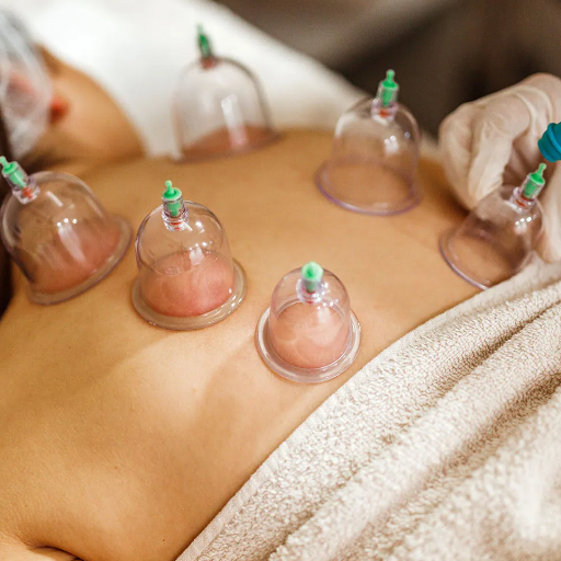 Is Hijama Haram? The Four Madhabs Agree (And Where They Differ)