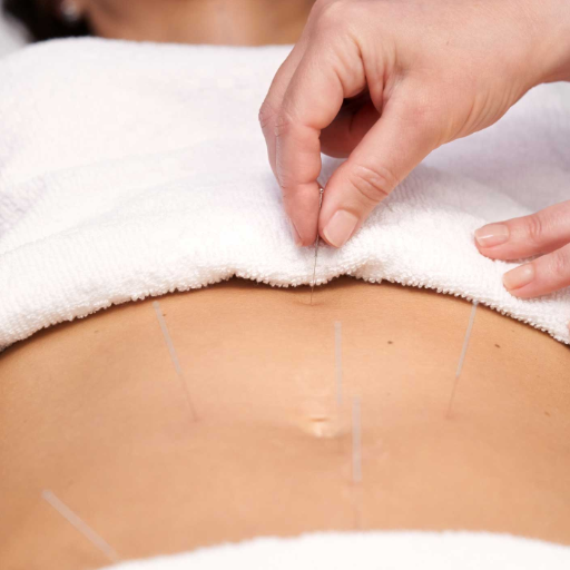 Chinese Herbal Medicine to Treat PCOS — Formulas and Mechanisms