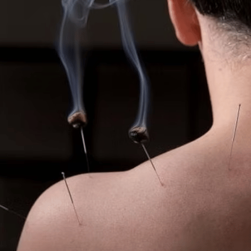 Five Acupuncture Points Every Moxibustion Patient Encounters