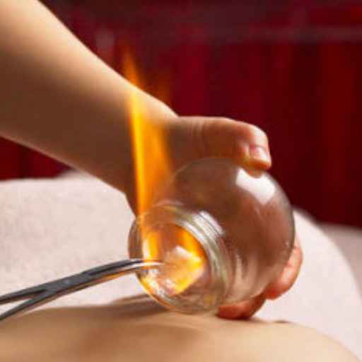 The 7-Point Halal Hijama Checklist: How to Choose a Halal Provider