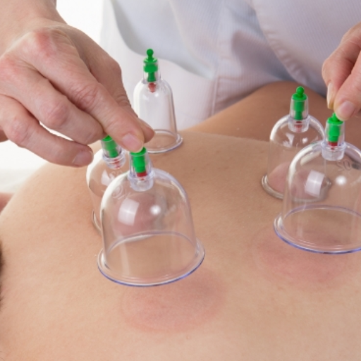 Documented Benefits of Hijama: Where Prophetic Medicine Meets Modern Evidence
