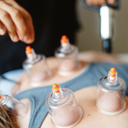 Hijama and Fasting in Islam: Does Wet Cupping Break Your Fast?