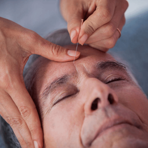 Acupuncture Safety at a Glance