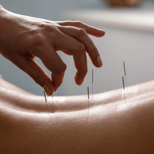 What Is Acupuncture? (And Where TCM Fits In)