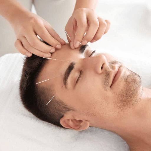 Where the Research Is Heading: The Acupuncture & Anxiety Outlook