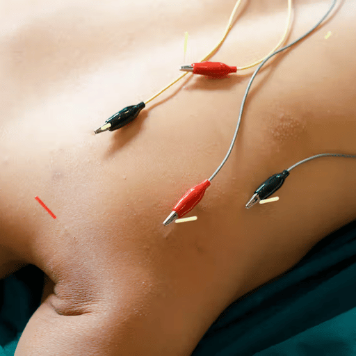 What's Changing in Acupuncture Comfort and Acceptance