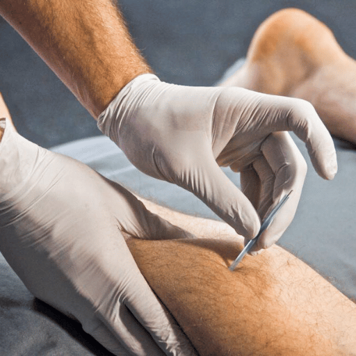 The Outlook: Scope-of-Practice and "Biomedicalized Needling"