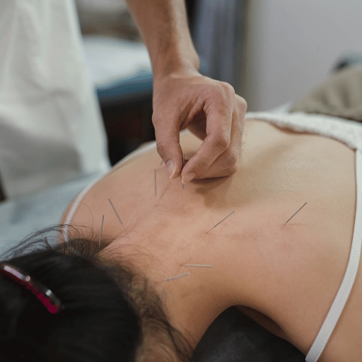Why Acupuncture Works as a Course, Not a One-Off