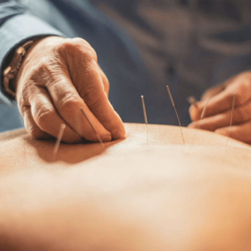 Does Acupuncture Actually Work? What the Evidence Says