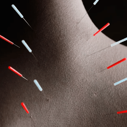How Acupuncture Works: Needles, Acupoints & the Science