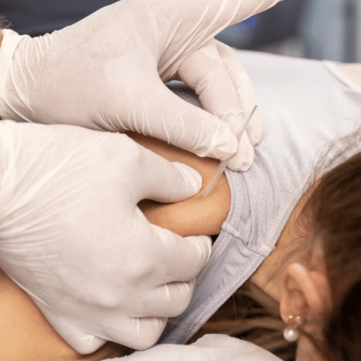 How Much Does Acupuncture Cost in Dubai, With and Without Insurance?