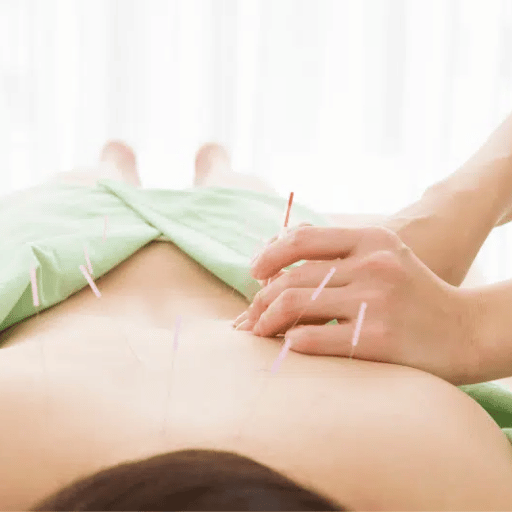 What to Expect at Your First Acupuncture Session