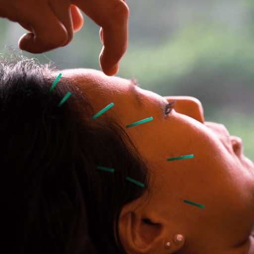 Acupuncture for Anxiety with Depression, Panic, and Insomnia
