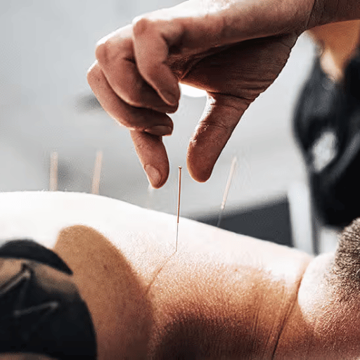 Signs Acupuncture Is Working, and When to Stop