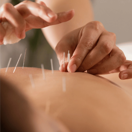 How to Claim Acupuncture Reimbursement: Step by Step