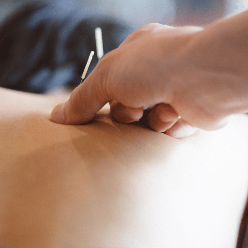 Acupuncture Aftercare Tips