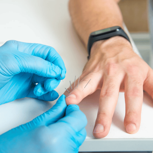 How Much Does Acupuncture Cost in Dubai?