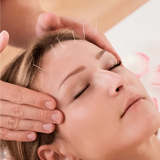 What to Expect at an Acupuncture Session for Anxiety