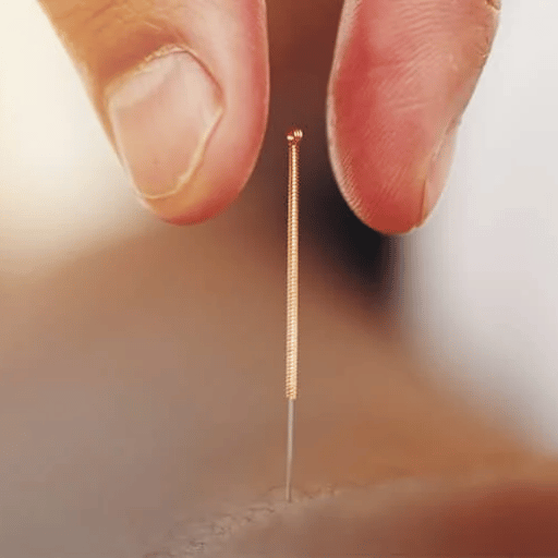 What's Changing: Acupuncture's Move to a "Minimum Effective Dose"