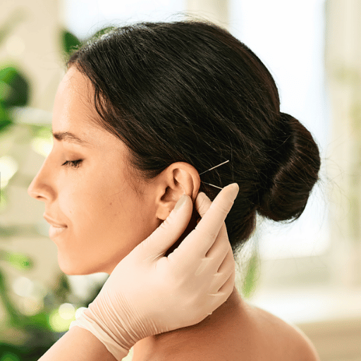 How to Choose a Licensed Acupuncture Clinic in Dubai