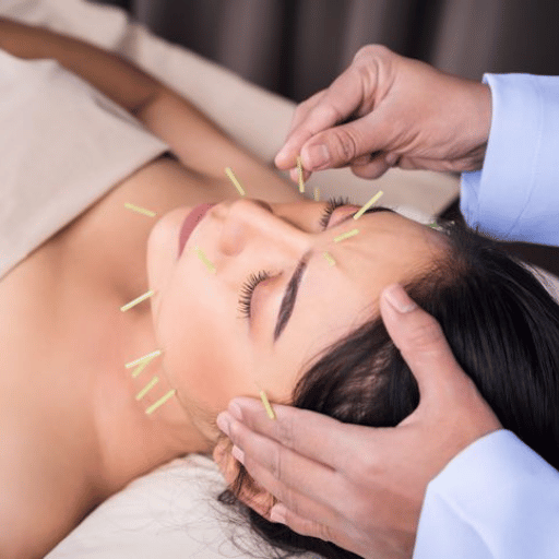 Is Acupuncture for Anxiety Safe? Side Effects and Cautions