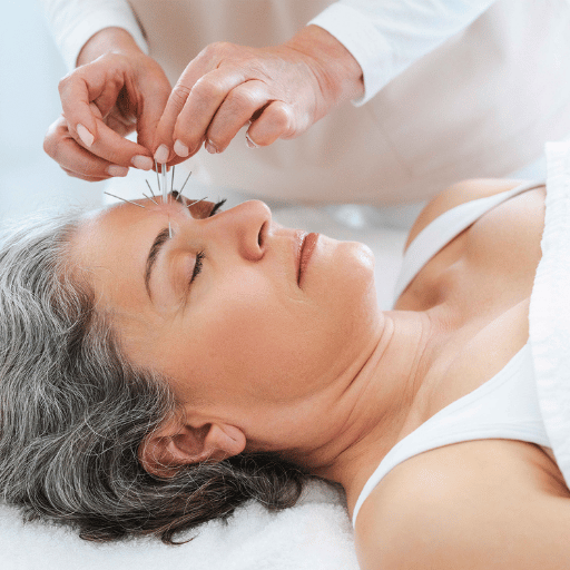 Acupuncture for Anxiety in Dubai: Cost, Insurance, and Booking