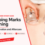 Cupping Marks Meaning: Color, Duration & Aftercare