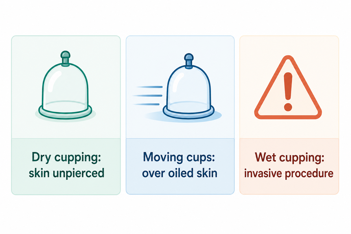 Dry, moving and wet cupping distinguished by skin contact and procedure type.